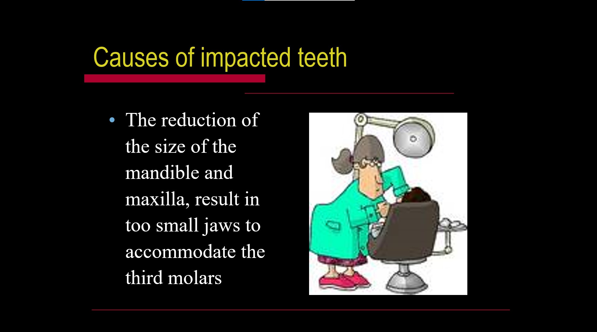 Impacted teeth1